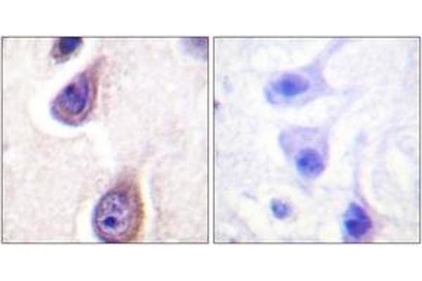 anti-Phospholipase D1 (PLD1) (AA 527-576), (pSer561) antibody