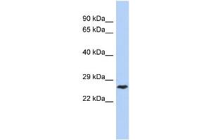 Image no. 1 for anti-DIRAS Family, GTP-Binding RAS-Like 1 (DIRAS1) (Middle Region) antibody (ABIN2785103)