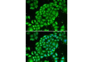 Image no. 1 for anti-T-Cell Leukemia/lymphoma 1A (TCL1A) antibody (ABIN3021014)