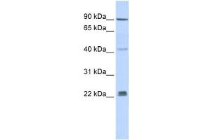 Image no. 1 for anti-Insulin Induced Gene 1 (INSIG1) antibody (ABIN2458475)