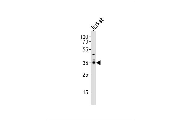 PPAP2A antibody  (C-Term)
