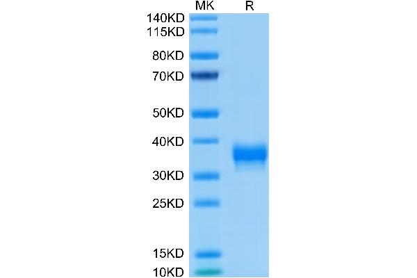 BTN1A1 Protein (His-Avi Tag,Biotin)