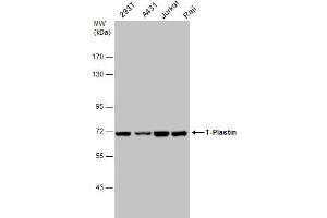 Image no. 4 for anti-Plastin 3 (PLS3) (Center) antibody (ABIN2855613)