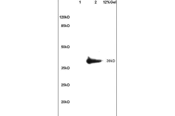 anti-Adenosine A2b Receptor (ADORA2B) (AA 101-200) antibody
