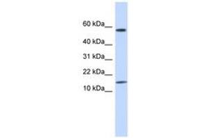 Image no. 1 for anti-Keratin Associated Protein 11-1 (KRTAP11-1) (N-Term) antibody (ABIN6740945)