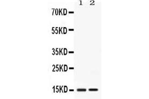 Image no. 1 for anti-Apolipoprotein C-III (APOC3) (AA 21-99) antibody (ABIN4886469)