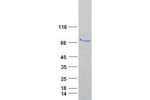 Image no. 1 for Arachidonate 15-Lipoxygenase (ALOX15) protein (Myc-DYKDDDDK Tag) (ABIN2714584)