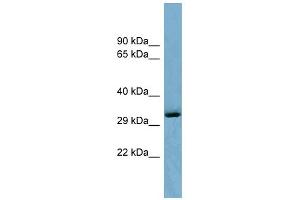 Image no. 1 for anti-OTU Domain Containing 6B (OTUD6B) (Middle Region) antibody (ABIN2786912)