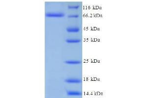 Image no. 1 for Cytochrome P450, Family 11, Subfamily A, Polypeptide 1 (CYP11A1) (AA 40-521) protein (His-SUMO Tag) (ABIN5709377)
