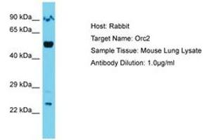Image no. 1 for anti-Origin Recognition Complex Subunit 2 (ORC2) (AA 382-431) antibody (ABIN6750366)