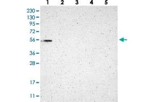 Image no. 1 for anti-Glucocorticoid Modulatory Element Binding Protein 2 (GMEB2) antibody (ABIN5578900)