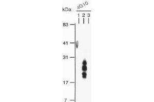 Image no. 3 for anti-Heparin-Binding EGF-Like Growth Factor (HBEGF) (Bound), (EGF Like Domain), (Soluble) antibody (ABIN3201018)