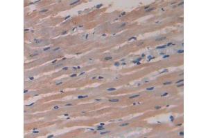 Image no. 3 for anti-Dystrophia Myotonica-Protein Kinase (DMPK) (AA 1-152) antibody (ABIN5013479)