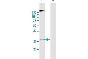Image no. 1 for anti-Transmembrane Protein 38A (TMEM38A) (AA 1-299) antibody (ABIN949628)