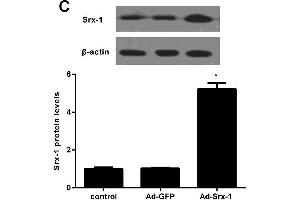 Image no. 4 for anti-Sulfiredoxin 1 (SRX1) (AA 45-137) antibody (ABIN1387599)