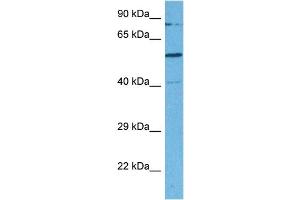 Image no. 3 for anti-SWI/SNF Related, Matrix Associated, Actin Dependent Regulator of Chromatin, Subfamily D, Member 2 (SMARCD2) (C-Term) antibody (ABIN2780464)