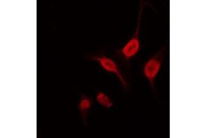 Image no. 1 for anti-Neurogenic Differentiation 2 (NEUROD2) antibody (ABIN6263551)