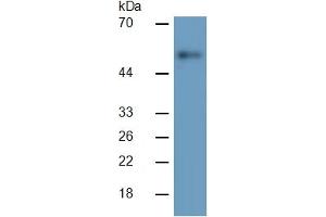 Image no. 4 for Matrix Metallopeptidase 3 (Stromelysin 1, Progelatinase) (MMP3) ELISA Kit (ABIN6730865)