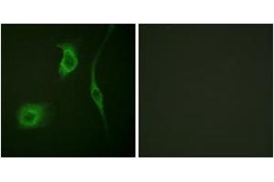Immunofluorescence analysis of HeLa cells, using HSP20 (Phospho-Ser16) Antibody.