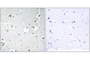 Image no. 2 for anti-Mitogen-Activated Protein Kinase 8 Interacting Protein 1 (MAPK8IP1) (AA 69-118) antibody (ABIN1532633)