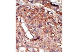 Image no. 2 for anti-Bromodomain Containing 2 (BRD2) (Middle Region) antibody (ABIN360494)