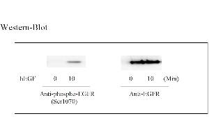 Image no. 4 for Epidermal Growth Factor Receptor (EGFR) ELISA Kit (ABIN625221)