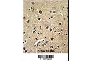 Image no. 2 for anti-Brain and Acute Leukemia, Cytoplasmic (BAALC) antibody (ABIN2157857)