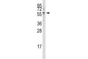 Image no. 2 for anti-K(lysine) Acetyltransferase 5 (KAT5) (AA 33-64) antibody (ABIN3031520)