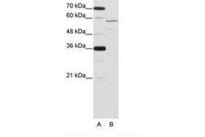 Image no. 1 for anti-Neuro-Oncological Ventral Antigen 2 (NOVA2) (AA 185-234) antibody (ABIN202652)