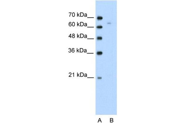 anti-Thymus High Mobility Group Box Protein (TOX) (N-Term) antibody