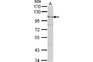 Image no. 3 for anti-ADAM Metallopeptidase Domain 15 (ADAM15) (N-Term) antibody (ABIN2855098)