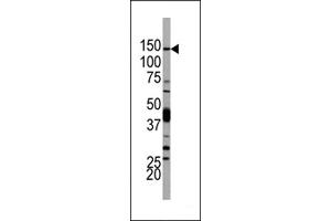 PIK3CD antibody  (N-Term)