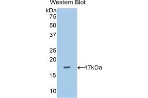 Image no. 4 for Solute Carrier Family 3 (Activators of Dibasic and Neutral Amino Acid Transport), Member 2 (SLC3A2) ELISA Kit (ABIN6720502)