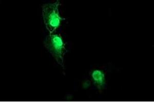 Image no. 2 for anti-Aryl Hydrocarbon Receptor Interacting Protein-Like 1 (AIPL1) antibody (ABIN2715816)