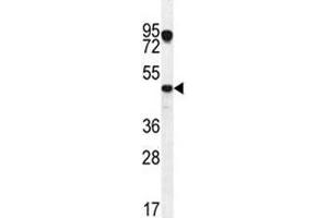 Image no. 5 for anti-Vascular Endothelial Growth Factor C (VEGFC) (AA 20-49) antibody (ABIN3029579)