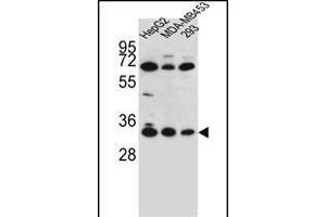 OR2T3 antibody  (C-Term)