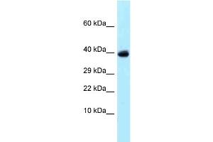 Image no. 1 for anti-Ubiquitin Specific Peptidase 4 (USP4) (C-Term) antibody (ABIN2789297)