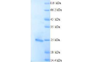 Image no. 1 for BCL2-Like 11 (Apoptosis Facilitator) (BCL2L11) (AA 1-198), (full length) protein (His tag) (ABIN5713280)