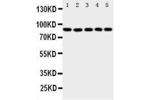 Image no. 2 for anti-Arachidonate 5-Lipoxygenase (ALOX5) (AA 650-667), (C-Term) antibody (ABIN3044238)