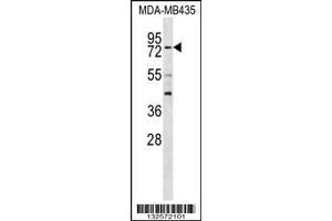 Image no. 1 for anti-Regulatory Factor X 3 (RFX3) (AA 661-690), (C-Term) antibody (ABIN656557)