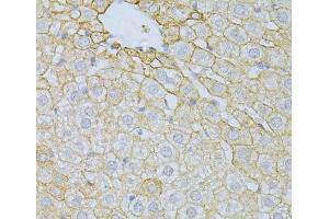 Immunohistochemistry of paraffin-embedded Rat liver using PLA2R1 Polyclonal Antibody at dilution of 1:100 (40x lens).