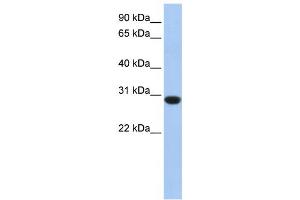 Image no. 1 for anti-Ankyrin Repeat and SOCS Box-Containing 12 (ASB12) antibody (ABIN2459538)