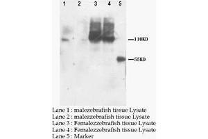 Image no. 1 for anti-Patatin-Like phospholipase Domain Containing 6 (PNPLA6) (AA 1323-1348), (C-Term) antibody (ABIN1108496)
