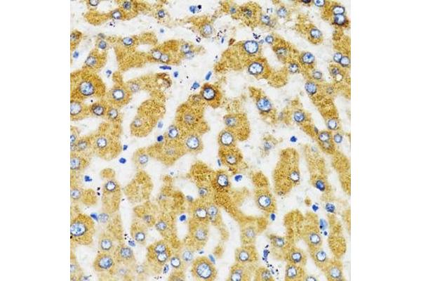 SLC27A2 antibody  (AA 30-200)
