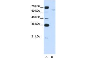 Image no. 1 for anti-Cytoplasmic Polyadenylation Element Binding Protein 2 (CPEB2) antibody (ABIN2462355)