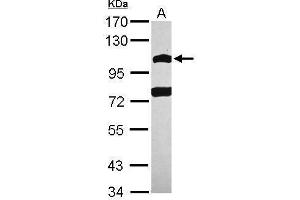 POM121 antibody  (N-Term)