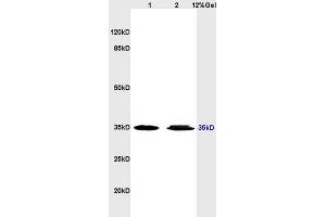 Lane 1: human colon carcinoma lysates Lane 2: human gastric carcinoma lysates probed with Anti ADORA3 Polyclonal Antibody, Unconjugated (ABIN673629) at 1:200 in 4C.