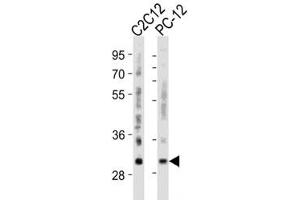 Image no. 3 for anti-B-Cell CLL/lymphoma 2 (BCL2) (AA 75-110) antibody (ABIN3030102)