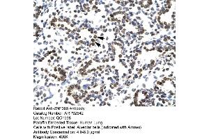 Image no. 1 for anti-Zinc Finger Protein 385A (ZNF385A) (N-Term) antibody (ABIN2779710)