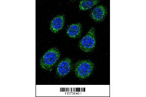 Image no. 3 for anti-Cytochrome P450, Family 3, Subfamily A, Polypeptide 5 (CYP3A5) (AA 476-502), (C-Term) antibody (ABIN392224)